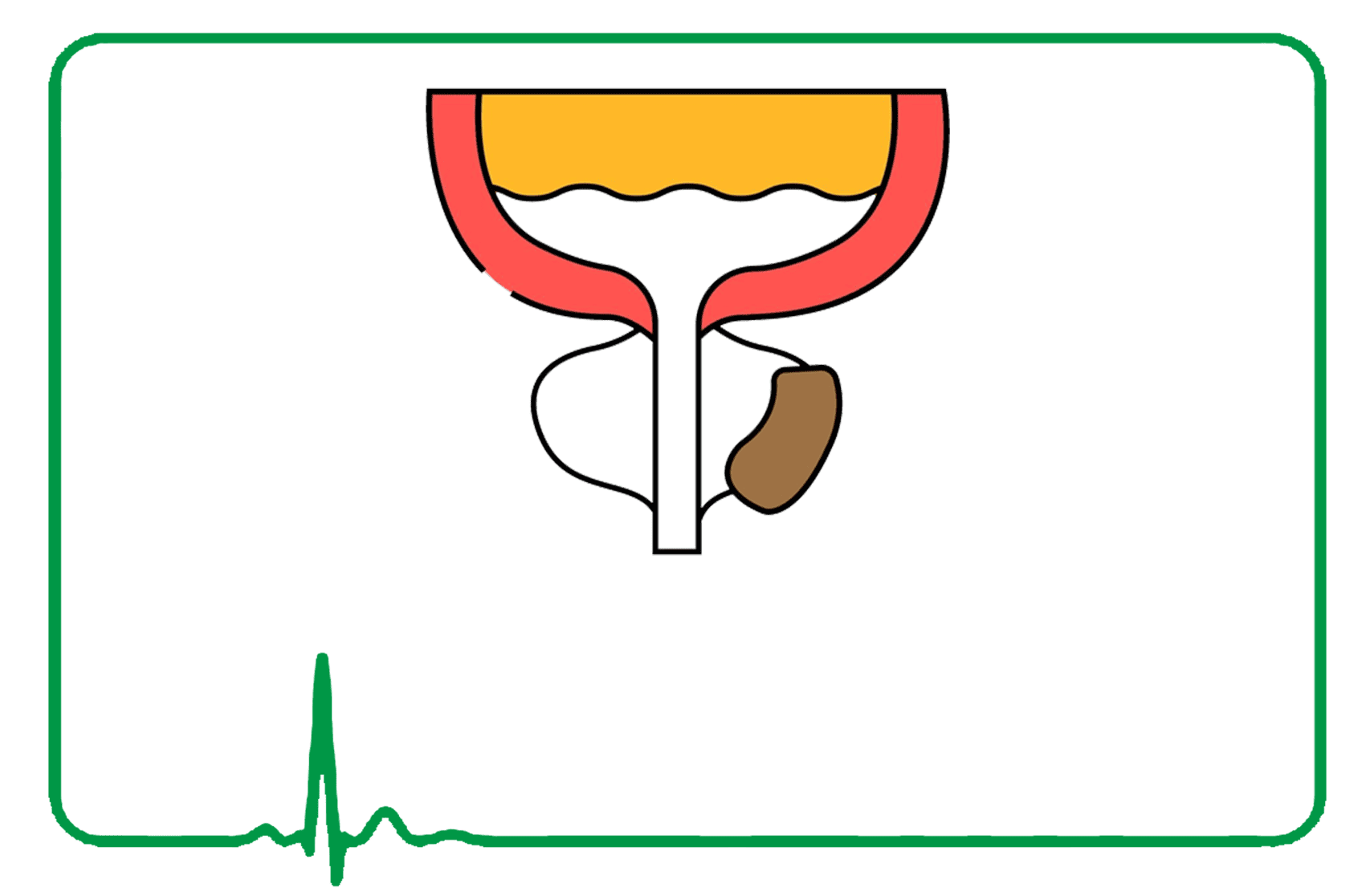 Overactive Bladder